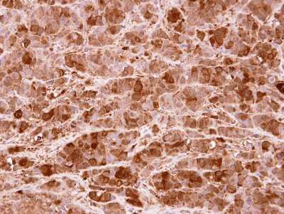 Immunohistochemistry-Paraffin: PRMT5 Antibody [NBP2-19935]