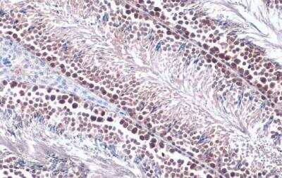 Immunohistochemistry-Paraffin: PRMT5 Antibody [NBP2-19935]