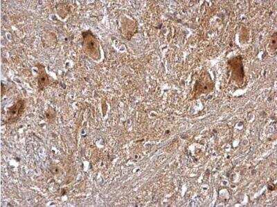 Immunohistochemistry-Paraffin: PRMT5 Antibody [NBP2-19937]