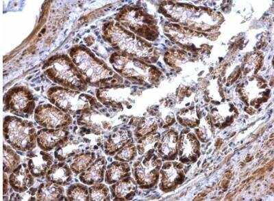 Immunohistochemistry-Paraffin: PRMT5 Antibody [NBP2-19937]