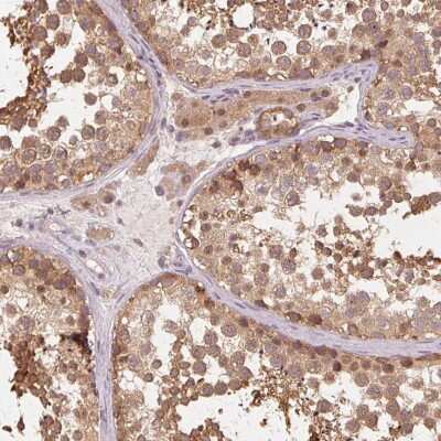 Immunohistochemistry-Paraffin: PRMT5 Antibody [NBP2-56041]