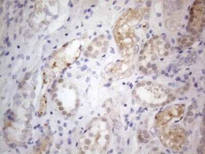 Immunohistochemistry: PRMT5 Antibody (OTI2H3) - Azide and BSA Free [NBP2-73604]