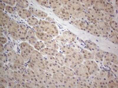 Immunohistochemistry: PRMT5 Antibody (OTI2H3) - Azide and BSA Free [NBP2-73604]
