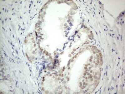 Immunohistochemistry: PRMT5 Antibody (OTI2H3) - Azide and BSA Free [NBP2-73604]