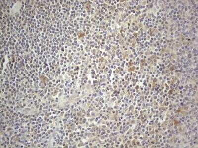 Immunohistochemistry: PRMT5 Antibody (OTI2H3) - Azide and BSA Free [NBP2-73604]
