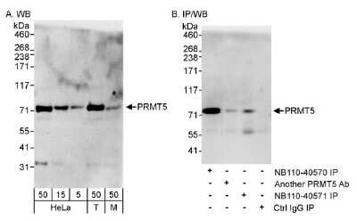 Western Blot: PRMT5 Antibody [NB110-40571]