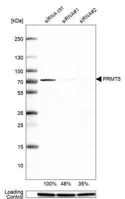 Western Blot: PRMT5 Antibody [NBP1-81701]