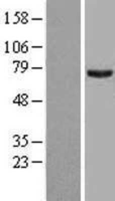 Western Blot: PRMT5 Overexpression Lysate [NBL1-14795]