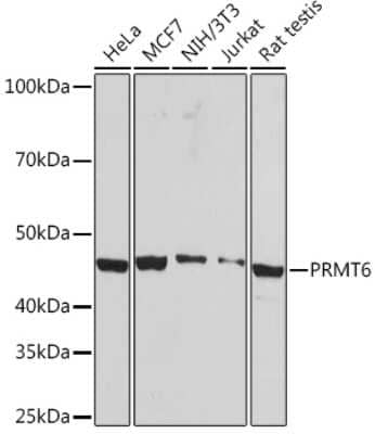 Western Blot: PRMT6 Antibody (1Z10L6) [NBP3-16549]