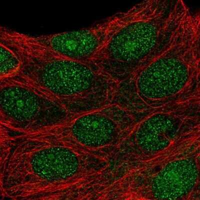 Immunocytochemistry/ Immunofluorescence: PRMT6 Antibody [NBP2-32459]