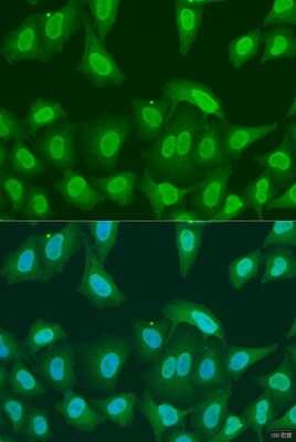 Immunocytochemistry/ Immunofluorescence: PRMT6 Antibody - Azide and BSA Free [NBP2-93696]
