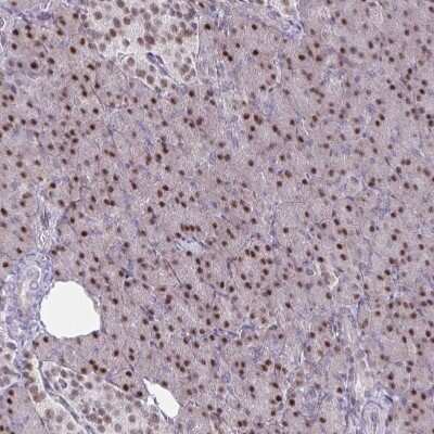 Immunohistochemistry-Paraffin: PRMT6 Antibody [NBP2-32459]