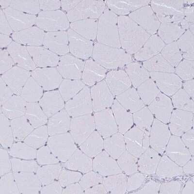 Immunohistochemistry-Paraffin: PRMT6 Antibody [NBP2-32459]