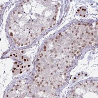 Immunohistochemistry-Paraffin: PRMT6 Antibody [NBP2-32459]