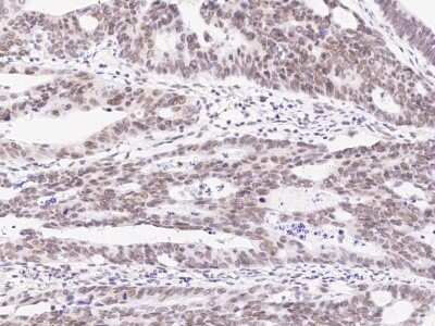 Immunohistochemistry-Paraffin: PRMT6 Antibody [NBP2-98848]