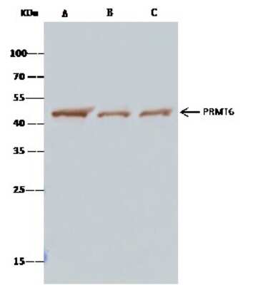 Immunoprecipitation: PRMT6 Antibody [NBP2-99773]