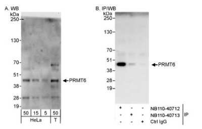 Western Blot: PRMT6 Antibody [NB110-40713]