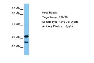 Western Blot: PRMT6 Antibody [NBP2-88092]