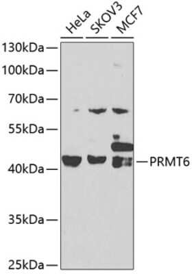 Western Blot: PRMT6 AntibodyAzide and BSA Free [NBP2-93696]