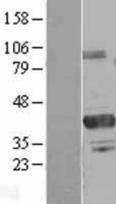 Western Blot: PRMT6 Overexpression Lysate [NBL1-14796]