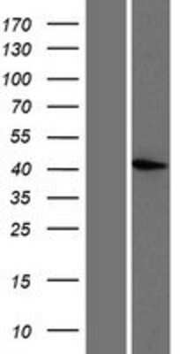 Western Blot: PRMT6 Overexpression Lysate [NBP2-10229]