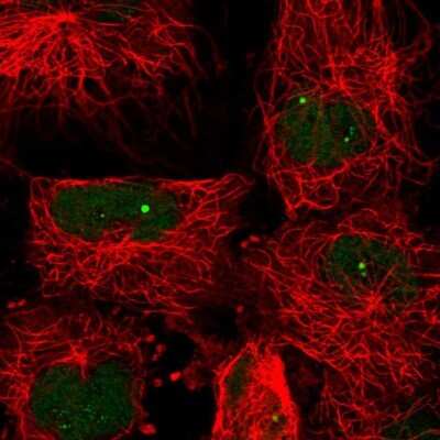 Immunocytochemistry/ Immunofluorescence: PRMT7 Antibody [NBP2-47322]