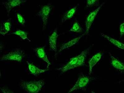 Immunocytochemistry/ Immunofluorescence: PRMT7 Antibody [NBP2-98849]