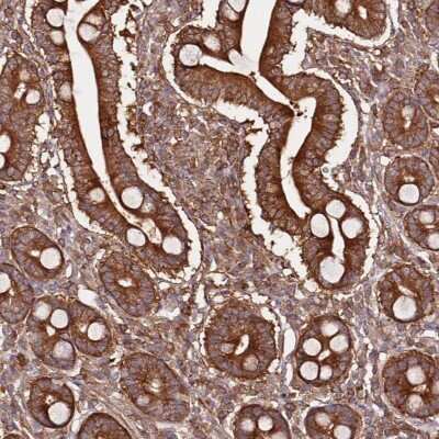 Immunohistochemistry: PRMT7 Antibody [NBP2-47322]