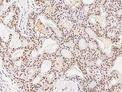 Immunohistochemistry-Paraffin: PRMT7 Antibody [NBP2-98849]