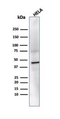 Western Blot: PRMT7 Antibody (PCRP-PRMT7-1A4) [NBP3-13741]