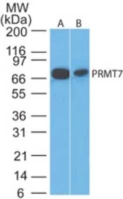 Western Blot: PRMT7 Antibody [NB100-56400]