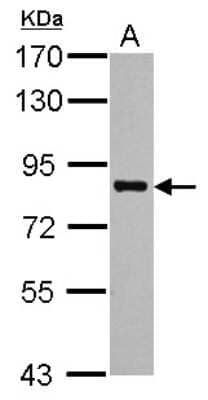 Western Blot: PRMT7 Antibody [NBP2-19938]