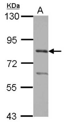 Western Blot: PRMT7 Antibody [NBP2-19939]