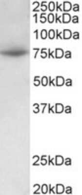 Western Blot: PRMT7 Antibody [NBP2-26135]