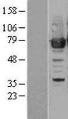 Western Blot: PRMT7 Overexpression Lysate [NBL1-14797]