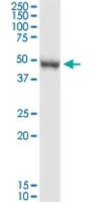 Western Blot: PRMT8 Antibody [H00056341-D01P]