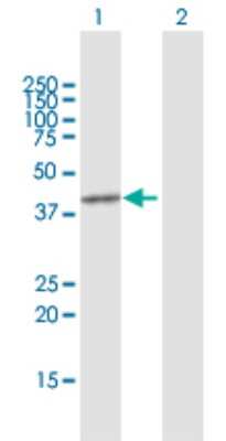 Western Blot: PRMT8 Antibody [H00056341-D01P]