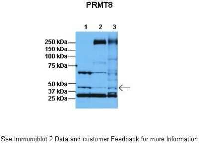 Western Blot: PRMT8 Antibody [NBP1-55401]