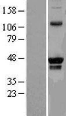 Western Blot: PRMT8 Overexpression Lysate [NBL1-14798]