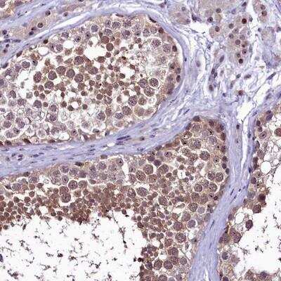 Immunohistochemistry-Paraffin: PRNT Antibody [NBP1-93533]