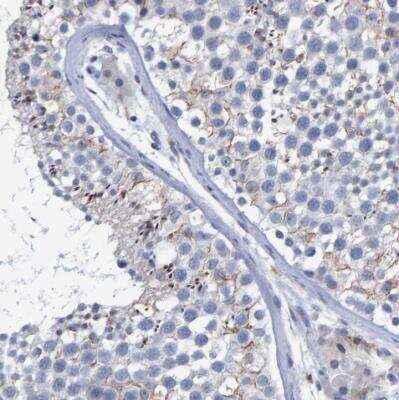 Immunohistochemistry-Paraffin: PROCA1 Antibody [NBP1-82698]