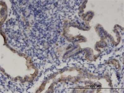 Immunohistochemistry-Paraffin: PRODH Antibody (3A9) [H00005625-M01]