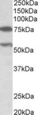 Western Blot: PRODH Antibody [NBP2-27548]