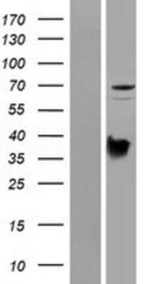 Western Blot: PRODH Overexpression Lysate [NBP2-07052]