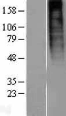 Western Blot: Prokineticin R1/PROKR1 Overexpression Lysate [NBP2-04419]