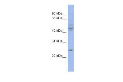 Western Blot: PROP1 Antibody [NBP3-10488]