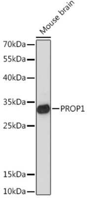 Western Blot: PROP1 AntibodyAzide and BSA Free [NBP3-15506]