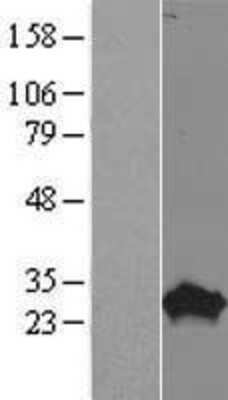 Western Blot: PROP1 Overexpression Lysate [NBP2-07650]