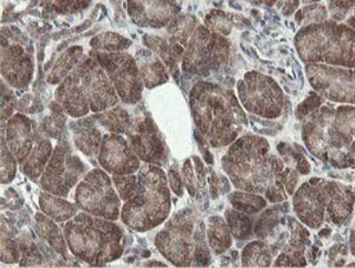 Immunohistochemistry: PROSC Antibody (OTI3G7) [NBP2-45396]