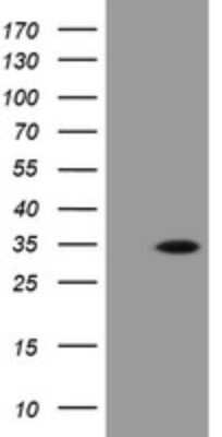 Western Blot: PROSC Antibody (OTI3G7) [NBP2-45396]